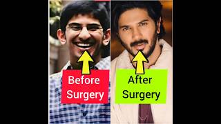 ഞെട്ടിപ്പോകും😱പ്ലാസ്റ്റിക് സർജറി ചെയ്ത് പണിപാളിയ മലയാള നടന്മാർ👄Plastic Surgery of malayalam actors👅👃