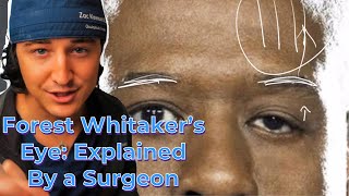 Forest Whitaker’s Eye- Explained by an Eyelid Surgeon | Understanding Ptosis