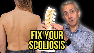 Does Scoliosis Cause Back Pain? Insights from a Spine Expert