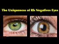 The Uniqueness of Rh Negatives Eyes