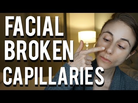 How to get rid of broken capillaries on the face| Dr Dray How to get rid of broken capillaries on the face| Dr Dray