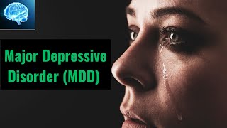 Major Depressive Disorder (MDD)