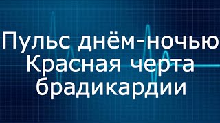 Нормальный пульс, тахикардия и брадикардия.| Normal heart rate day and night