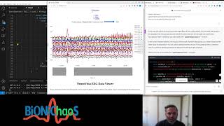 Biomedical EEG Data Web-App Development -Numpy -Pandas -Scipy -Plotly -Flask -GPT-4 -Python