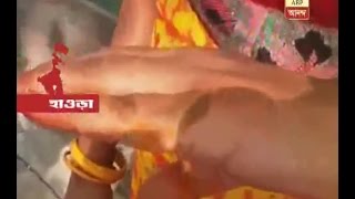 Howrah: Acid attack on Ex-army man and his wife and daughter at Bauria