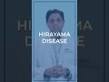 Hirayama Disease | Dr. Dhananjaya Bhat | Neurosurgery | Aster RV