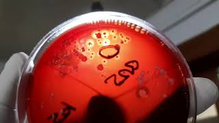 Beta-haemolytic colonies of Bacteria Demonstration