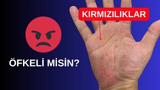 Elinizdeki Kırmızılıkların Anlamı Nedir? #öfke #tepki #fizyonomi #elçizgileri