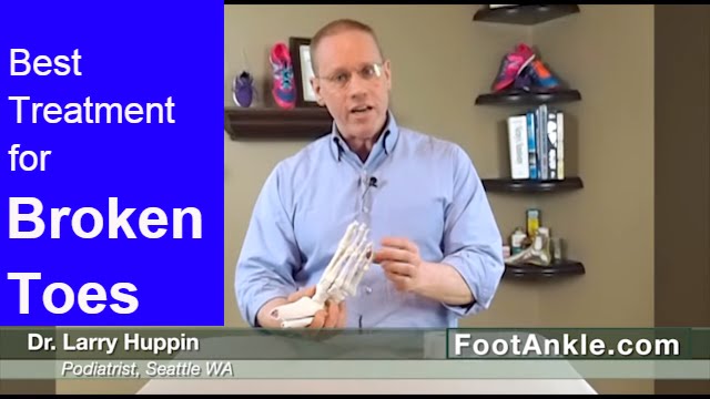 What Is The Best Treatment For A Broken Toe? (and Why You Should NEVER ...