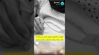 سنابات فايروس #فايروس