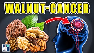 Never Eat Walnut with "This" Cause Cancer and Dementia! 3 Best & Worst Food Recipe! Dr.John