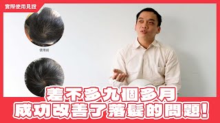 iRestore雷射生髮帽《實際使用心得見證》吳先生成功改善了前額禿的問題