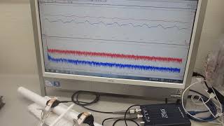 基礎実験ーーメガヘルツ超音波を利用した「振動技術」（振動モードの改善・調整）