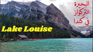 أشهر بحيرات كندا، بحيرة لويز/لويس | Lake Louise