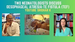 Practical discussion on Oesophageal atresia and TEF Dr Tala Dr Sridhar #esophagealatresia #tef #nicu