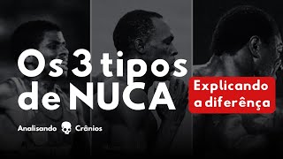 PERFORMANCE FÍSICA - A diferença entre os 3 formatos de nuca