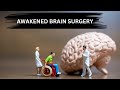 Awakened Brain Surgery|Revolutionary Technique Explained|#viralvideo #info corridor#facts