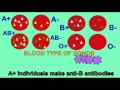 AP2 EXAM 1: BLOOD: TRANSFUSIONS FOR A+ BLOOD