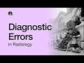 Diagnostic Errors in Radiology