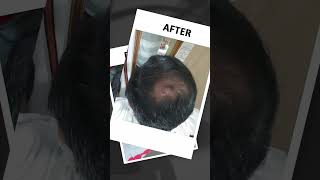 Super Results, Kalyaniammas 😍 |  Mudikozhichil Maran | Hairfall #Hair oil #malayalam #kalyaniammas