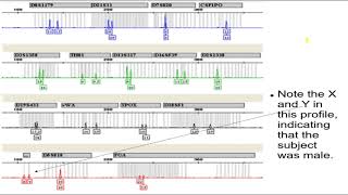 Forensics 16b Usage of DNA 2 Reading the DNA Profile, Y Chromosome Usage, MiniSTRs, the DNA Forensic