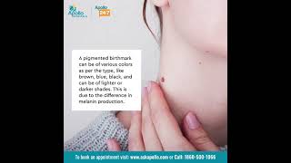 What are pigmented birthmarks? How are pigmented birthmarks diagnosed? | Apollo Hospitals