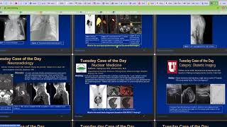 Virtual RSNA 2020: How to view lectures, educational exhibits and cases of the day