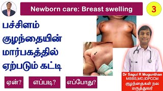 3. பச்சிளம் குழந்தையின் மார்பகத்தில் ஏற்படும் கட்டி | Breast swelling in newborn baby - TAMIL