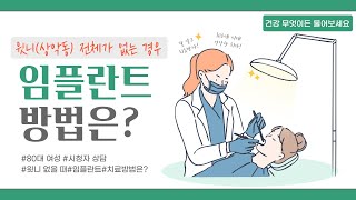 [건강매거진] 윗니 전체가 없는 경우, 임플란트 치료 가능할까??