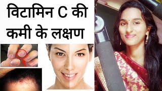 विटामिन सी (C) की कमी के 10 प्रमुख लक्षण || Symptoms of Vitamin C deficiency