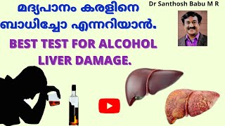 മദ്യപാനം കരളിനെ ബാധിച്ചോ എന്നറിയാൻ | BEST TEST FOR ALCOHOL LIVER DAMAGE.