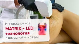 Инновационная MATRIX - LED технология в лазерной эпиляции. Как это?