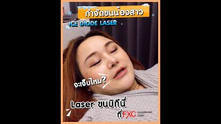 รีวิวเลเซอร์กำจัดขนน้องสาว ICE Diode Laser นวัตกรรมเลเซอร์แบบเย็น | FaceXercise Clinic