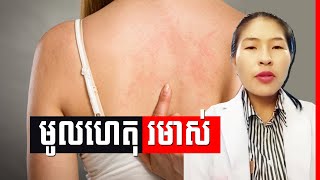 តើហេតុអ្វីបានចេះតែរមាស់? , Why is it itchy ?