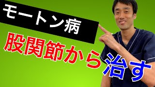 【モートン病を治し方】股関節から痛みとしびれを改善する方法｜足の悩み解消専門チャンネル