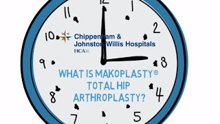 CJW Doc Minute: What is Makoplasty total hip arthroplasty?