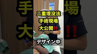 【リアル】手術の流れ大公開!!!【二重整形】#Shorts