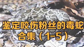 Collection of identification of venomous snakes that bite fans (1-5)