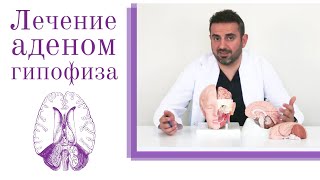 Аденома гипофиза: симптомы, причины и методы лечения