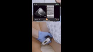 Mastering Ultrasound-Guided Procedures: 3 Pillars for Safety and Success!