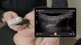 Ultrasound of the Nose and Forehead