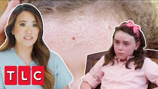 Dr Lee Helps 9-Year-Old Girl With Severe Psoriasis | Dr Pimple Popper: Pop Ups