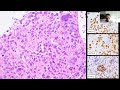 pathoradiological corr cases lung – surgical pathology and cytology