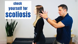 How To Check For Scoliosis - 4 Self Checks!