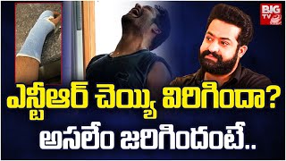 ఎన్టీఆర్ చెయ్యి విరిగిందా? | Jr NTR Team Clarification On Accident Rumors | BIG TV Andhra Pradesh