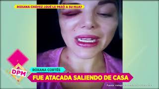 Agreden violentamente a hija de Roxana Chávez | De Primera Mano