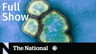 CBC News: The National | Potential community spread of measles