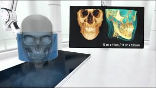 케어스트림덴탈 전산화단층촬영장치 CBCT - CS 9300