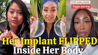The Shocking Truth Behind Cosmetic Surgery Nightmares