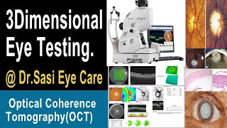 Optical Coherence Tomography( OCT MACHINE ) 3D Eye Testing to know all about eye defects.